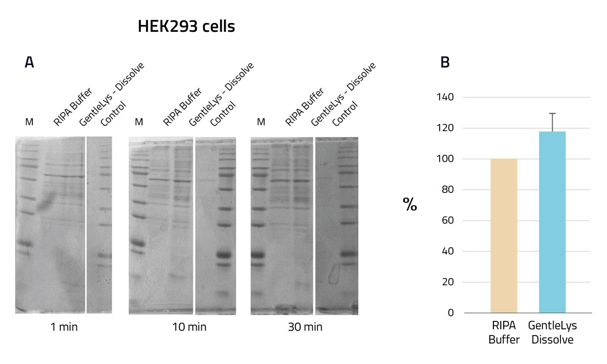 Comparison RIPA buffer vs GentleLys Dissolve Buffer using HEK293 cells - SDS Page; Quantification of comparison between RIPA buffer and GentleLYs buffer in HEK293 cells